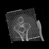 SPORK, NICO - 22.03.1976 - 02.08.2022 - CT obere Extremität - 18:01:46